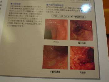 腸内画像