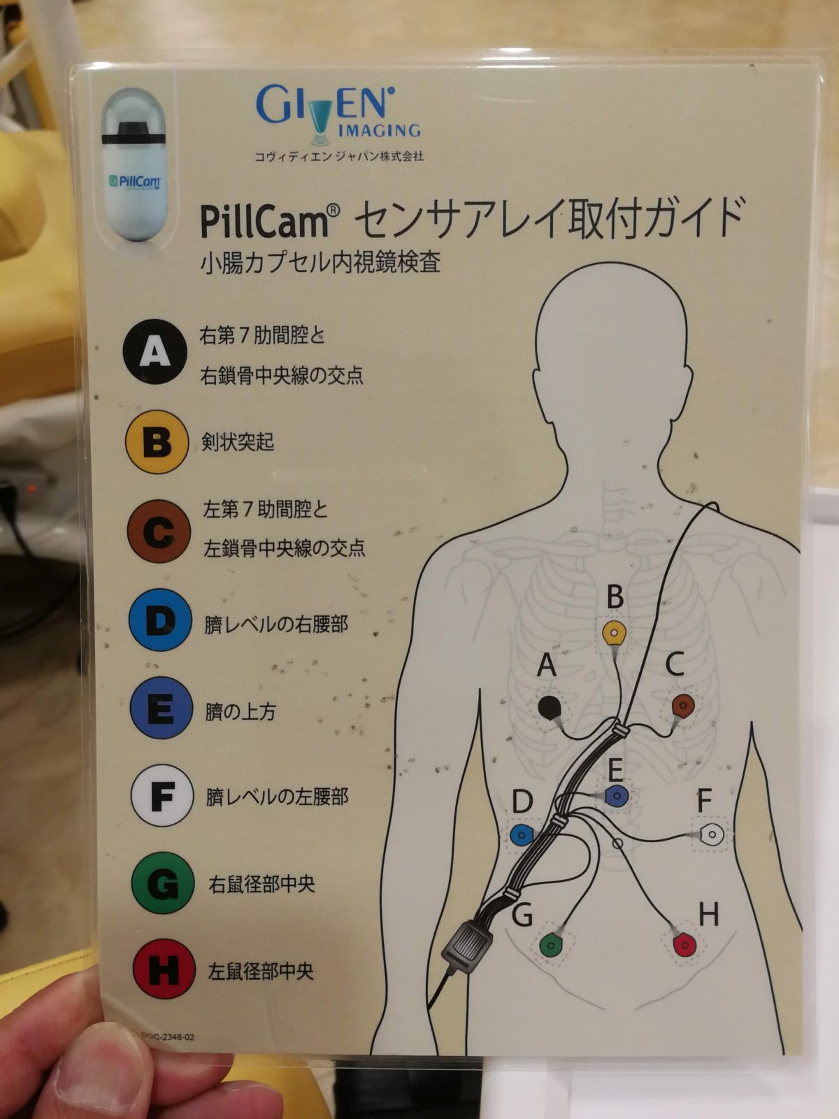 アンテナの取り付け位置