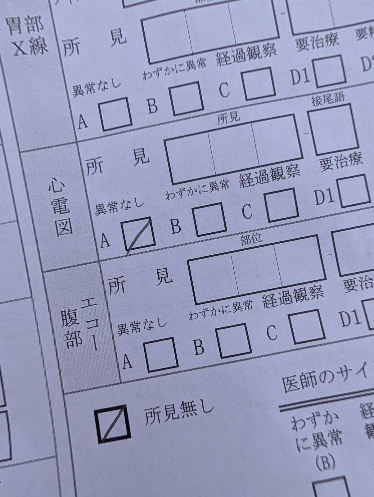 心電図の所見