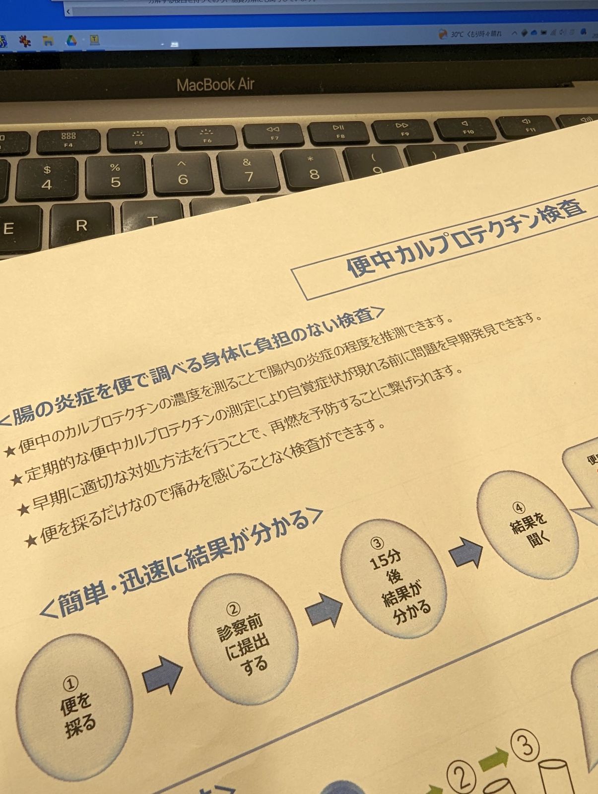 便中カルプロテクチン検査